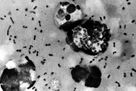 Diagnostican a residente de Oregon con peste bubónica. ¿Qué debes saber de la enfermedad?