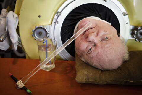 Paul Alexander thrived while using an iron lung for decades after contracting polio as a child