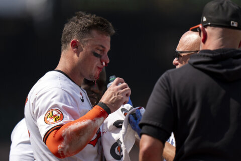 Orioles catcher James McCann shrugs off fastball to face, stays in game after being bloodied