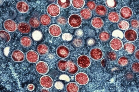 Sweden reports 1st case of more infectious form of mpox first identified in Congo