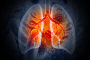 DC ranks 4th for lung cancer screening, report finds