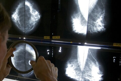 Some breast cancer patients can avoid certain surgeries, studies suggest