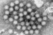 Nasty norovirus is back in full force with US cases of the stomach virus surging