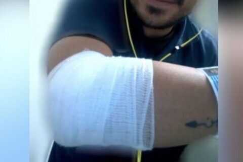 “Una camioneta me pegó”: hombre denuncia presunto atropello por agentes migratorios en D.C.