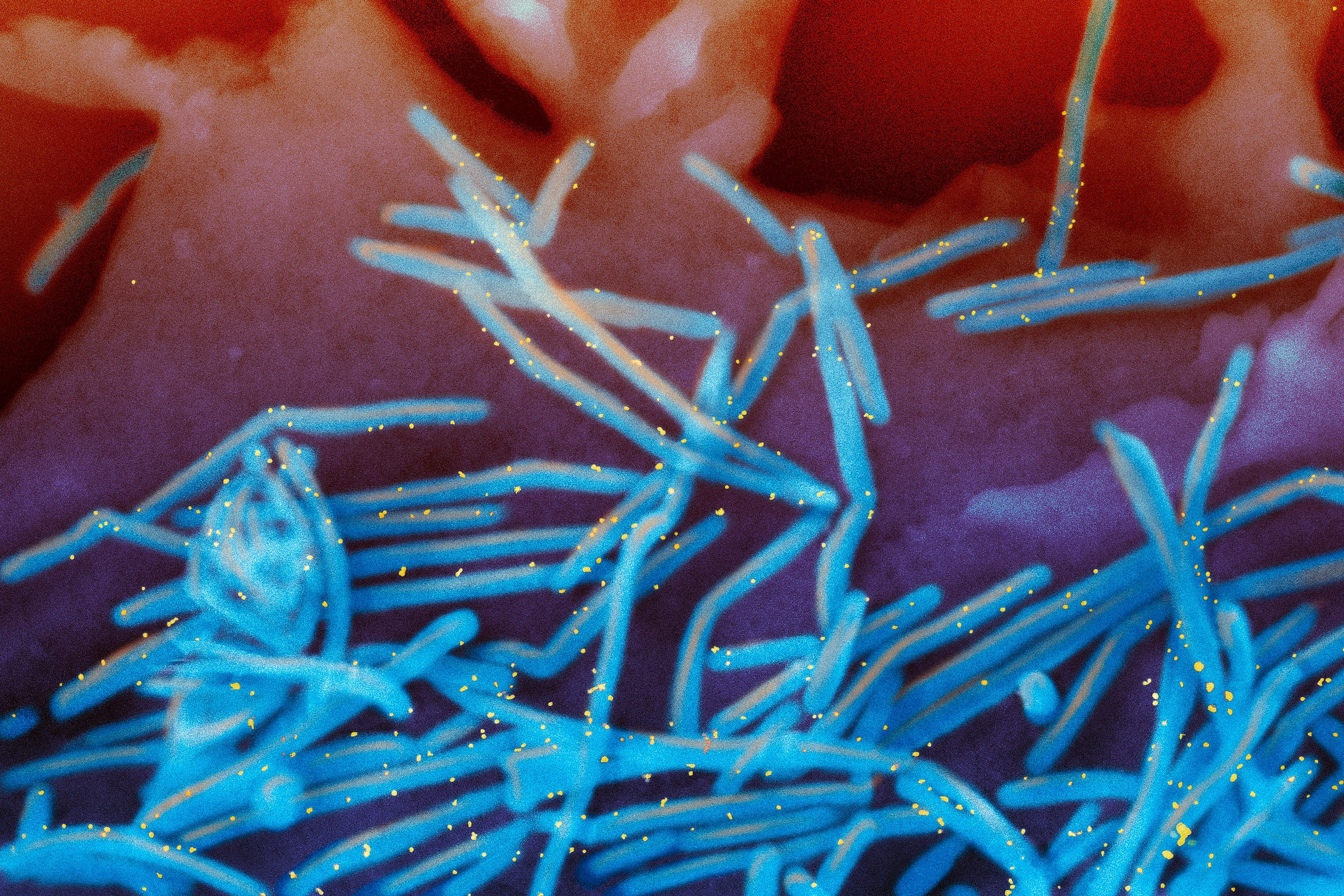 Winter virus season so far is not too bad, but doctors worry about suffering to come - WTOP