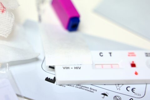 Te las puedes hacer tú mismo: recomiendan nuevo método para la prueba de VPH