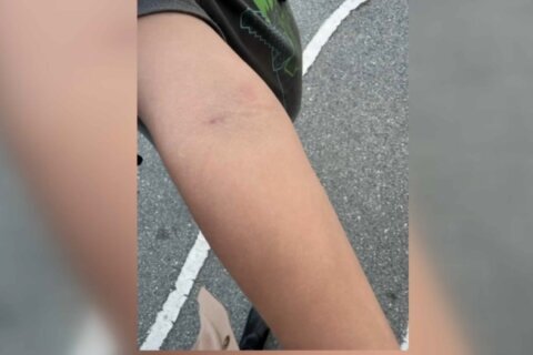 “Un maestro me pegó”: hispana denuncia presunta agresión a su hijo de 6 años