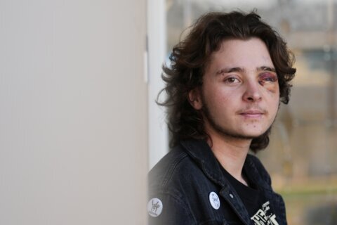 California protester left blind in one eye is among string of violent run-ins with federal agents