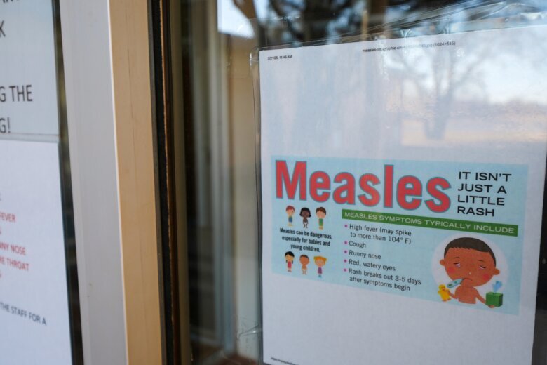 Measles