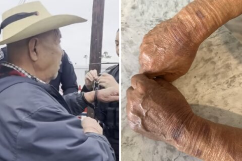“Se me estaban poniendo moradas las manos”: abuelo denuncia lesiones tras detención por CBP