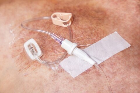 Nuevo logro en la lucha contra el cáncer: 7 de cada 10 pacientes sobreviven más de cinco años