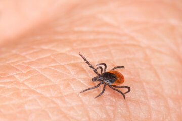 Parasite castor bean, black-legged or deer tick on a human skin detail. Ixodes ricinus