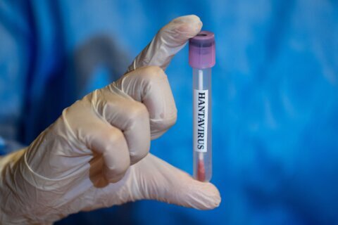 Hantavirus: ¿qué es, cómo se contagia y cuáles son sus síntomas? Te explicamos
