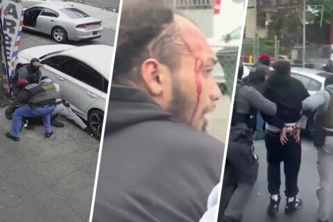 Múltiples heridas y golpes: joven denuncia brutal agresión por parte de presuntos agentes de ICE