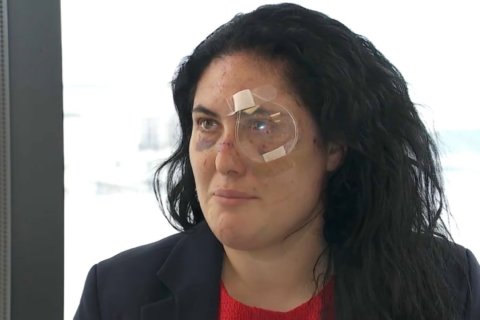 ‘Pensé que iba a morir’: mujer apuñalada en el ojo relata momentos de terror