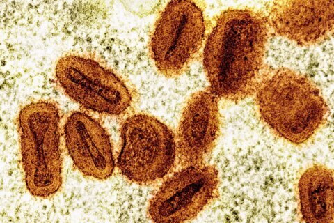 2 scientists charged with bringing deactivated mpox virus into the US and lying to authorities