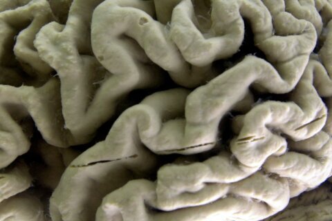 Study shows a blood test can help identify healthy people at high risk for Alzheimer’s disease
