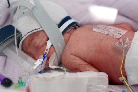 After an extremely rare pregnancy, an Australian woman gives birth to identical quadruplet girls