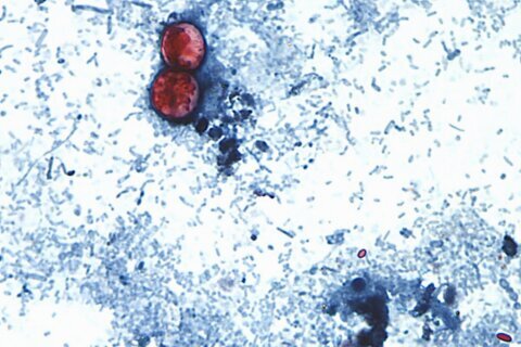 Foodborne illnesses at restaurant chains are rare but can sicken customers, roil businesses