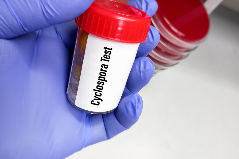 Technician holding a specimen container with stool sample for cyclospora test, to diagnosis of cyclosporiasis by examining under a microscope and finding oocysts.