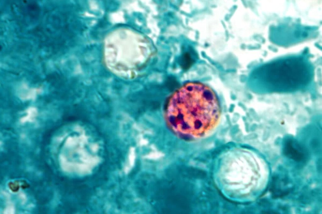 Maryland confirms nearly 150 cases of diarrhea-causing parasite