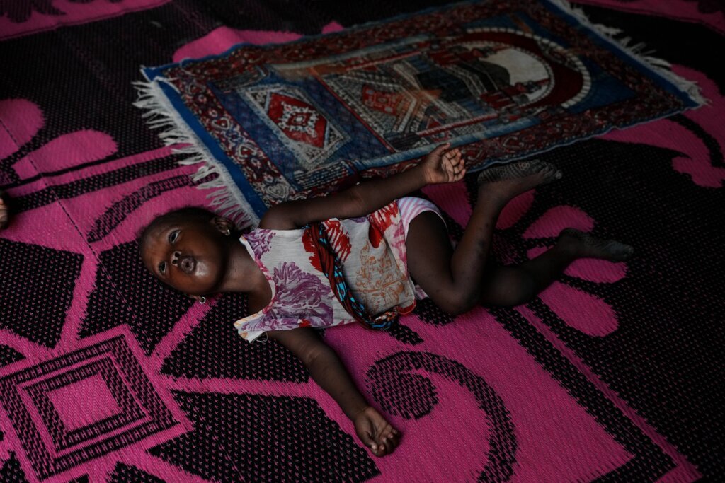 Nigerian children pay the price for the Iran war as malnutrition and poverty surge