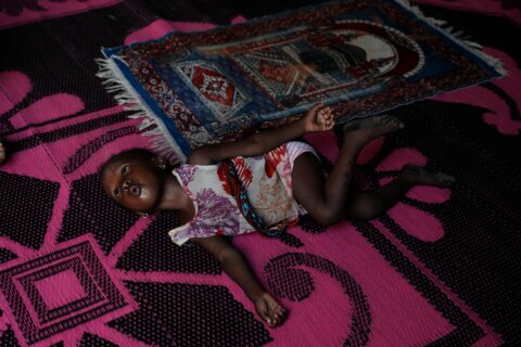 Nigerian children pay the price for the Iran war as malnutrition and poverty surge